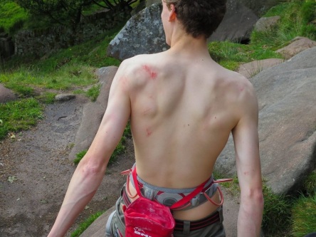 My Back After Doing Siftas' Quid